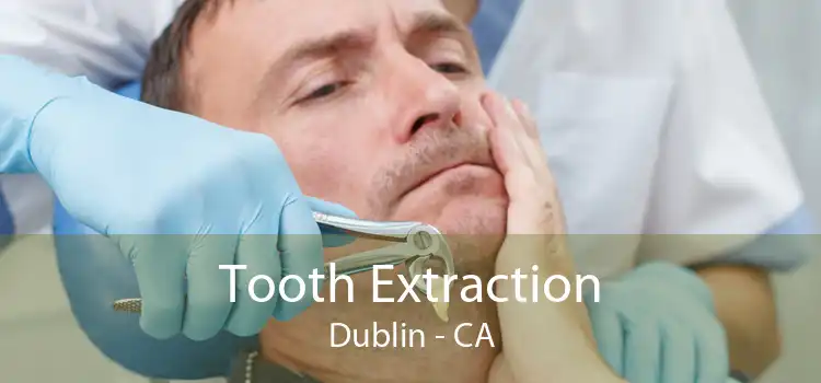 Tooth Extraction Dublin - CA