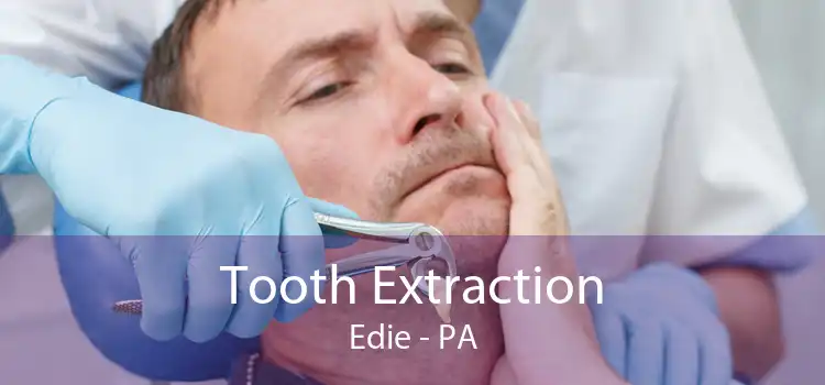 Tooth Extraction Edie - PA