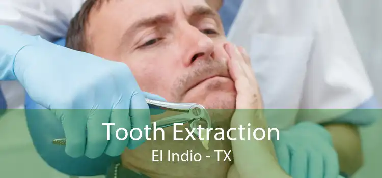 Tooth Extraction El Indio - TX