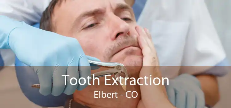 Tooth Extraction Elbert - CO