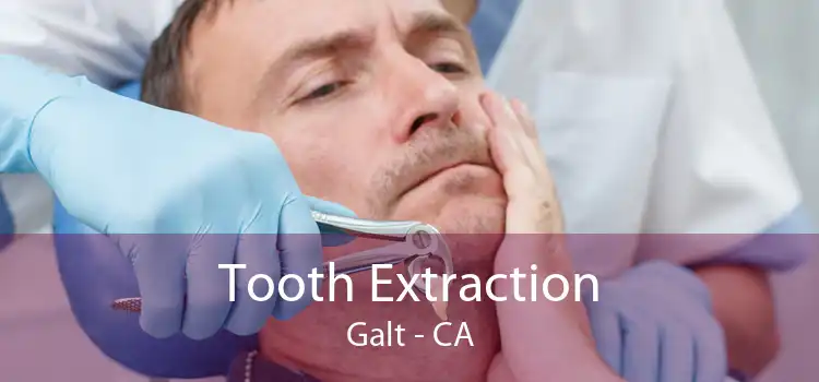 Tooth Extraction Galt - CA