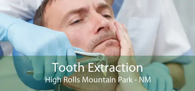 Tooth Extraction High Rolls Mountain Park - NM