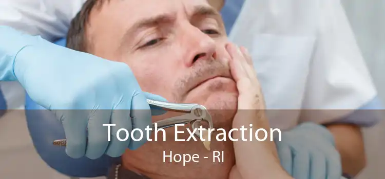 Tooth Extraction Hope - RI