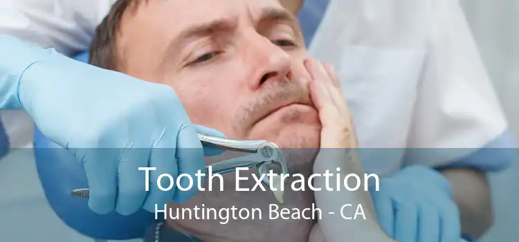 Tooth Extraction Huntington Beach - CA