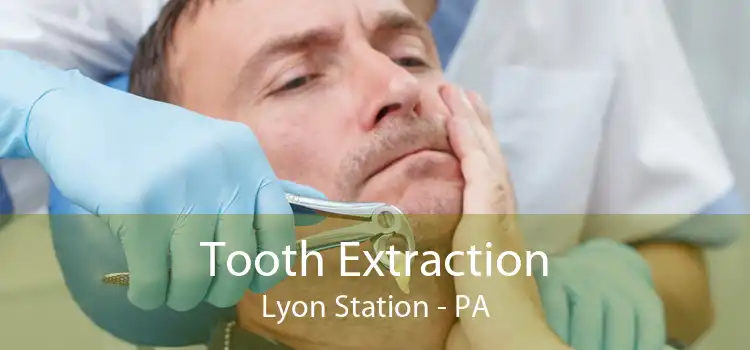 Tooth Extraction Lyon Station - PA