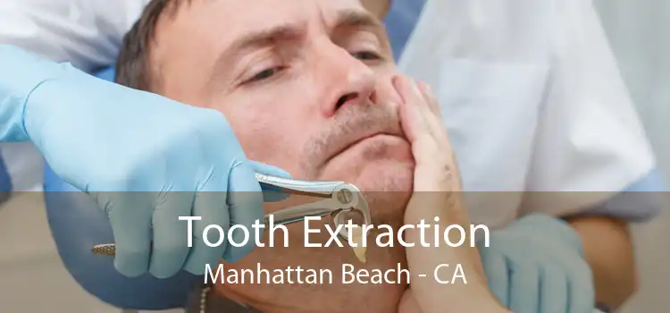 Tooth Extraction Manhattan Beach - CA