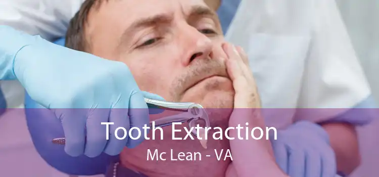 Tooth Extraction Mc Lean - VA