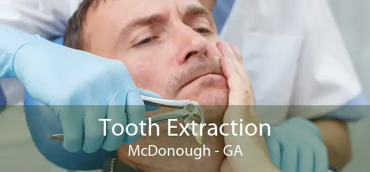 Tooth Extraction McDonough - GA