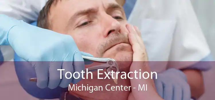 Tooth Extraction Michigan Center - MI