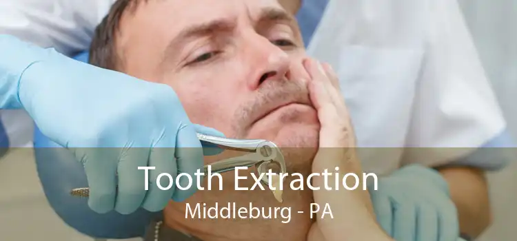 Tooth Extraction Middleburg - PA
