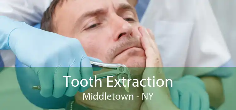 Tooth Extraction Middletown - NY