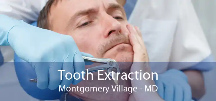 Tooth Extraction Montgomery Village - MD