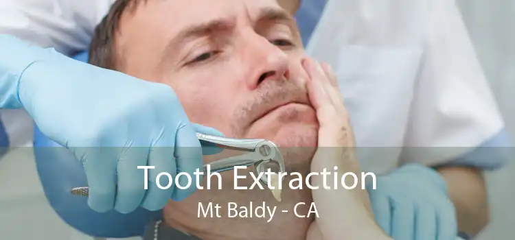 Tooth Extraction Mt Baldy - CA