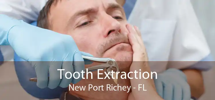 Tooth Extraction New Port Richey - FL