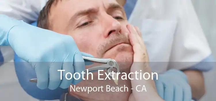 Tooth Extraction Newport Beach - CA