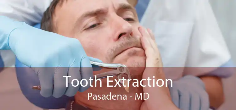 Tooth Extraction Pasadena - MD