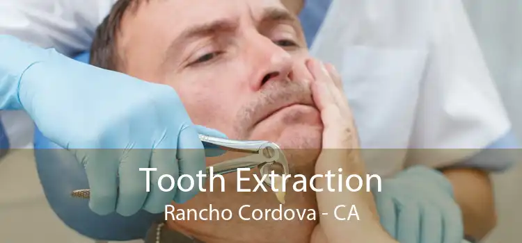 Tooth Extraction Rancho Cordova - CA