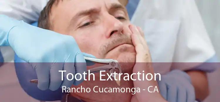 Tooth Extraction Rancho Cucamonga - CA