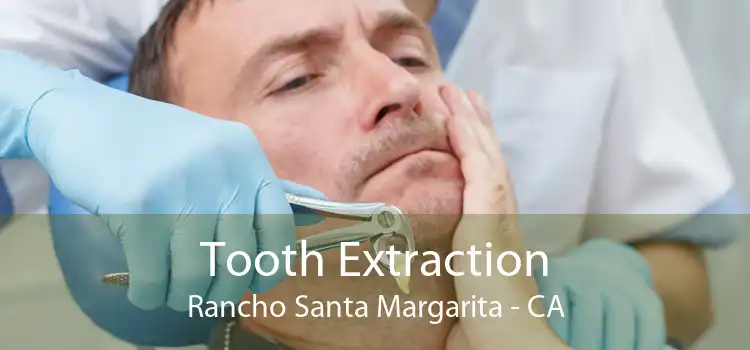 Tooth Extraction Rancho Santa Margarita - CA
