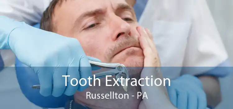 Tooth Extraction Russellton - PA