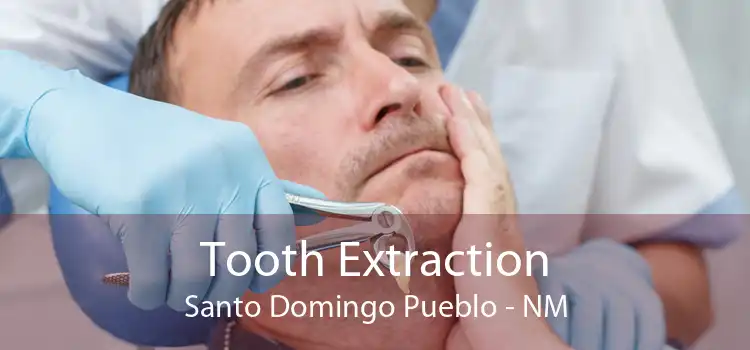 Tooth Extraction Santo Domingo Pueblo - NM