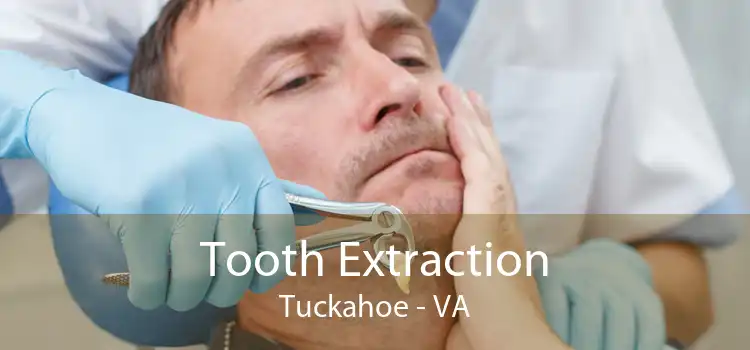 Tooth Extraction Tuckahoe - VA