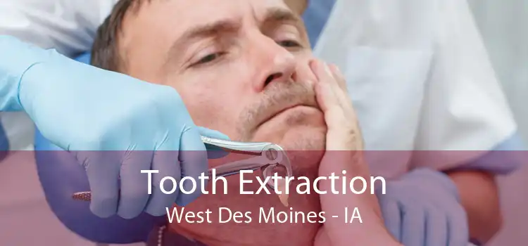 Tooth Extraction West Des Moines - IA