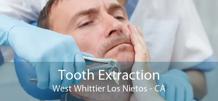 Tooth Extraction West Whittier Los Nietos - CA