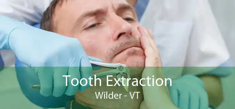 Tooth Extraction Wilder - VT