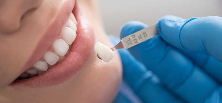 Pediatric Dental Crowns in Morristown, NJ