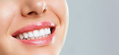 Teeth Whiting in Polacca